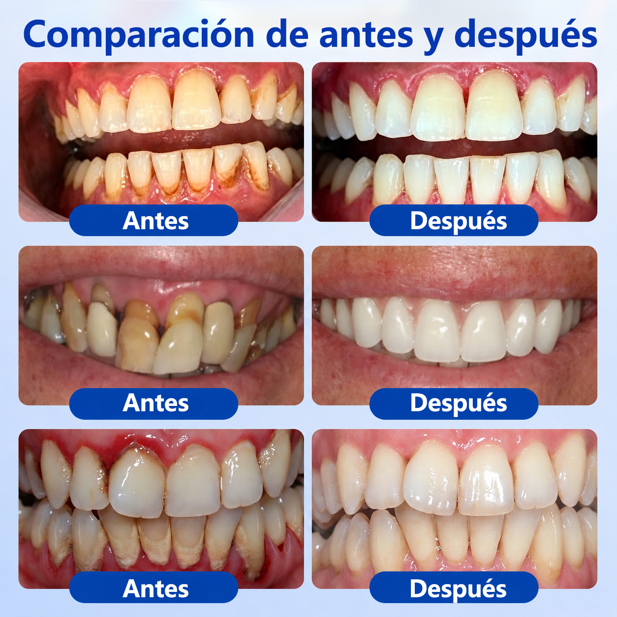 𝐂𝐞𝐫𝐭𝐢𝐟𝐢𝐜𝐚𝐝𝐨 𝐩𝐨𝐫 𝐎𝐝𝐨𝐧𝐭ó𝐥𝐨𝐠𝐨𝐬✨𝑽𝐢𝘁𝒂𝒍𝒊𝒔𝒚𝒔®🦷 𝑮𝒖𝒎𝑹𝒆𝒗𝒊𝒗𝒆 𝑮𝒆𝒍 𝑹𝒆𝒑𝒂𝒓𝒂𝒅𝒐𝒓 𝑷𝒆𝒓𝒊𝒐𝒅𝒐𝒏𝒕𝒂𝒍💕