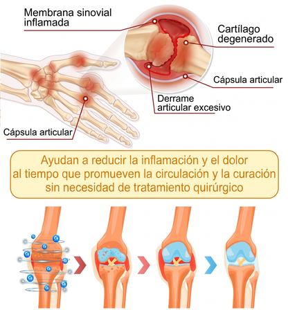30 % de descuento 🎁🎁 | Crema 𝐌𝐔𝐑𝐖𝐎𝐍® con veneno de abeja para aliviar el dolor y favorecer el bienestar articular ✨✨✨ (Especialmente para personas mayores)