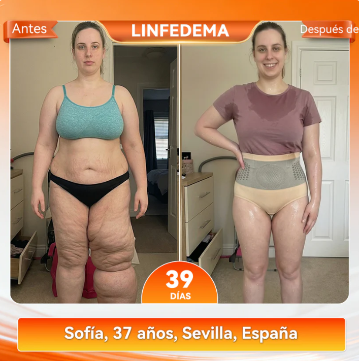 30%🎁 🎁 𝑩𝑳𝑼𝑬𝑺𝑯𝑶𝑻® 2026 – Pantalones Cortos 4 en 1 con Micro-Partículas de Moringa & Berberina para Moldear y Quemar Grasa