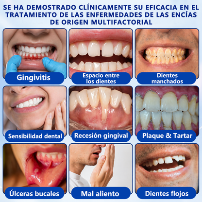 𝐂𝐞𝐫𝐭𝐢𝐟𝐢𝐜𝐚𝐝𝐨 𝐩𝐨𝐫 𝐎𝐝𝐨𝐧𝐭ó𝐥𝐨𝐠𝐨𝐬✨𝑽𝐢𝘁𝒂𝒍𝒊𝒔𝒚𝒔®🦷 𝑮𝒖𝒎𝑹𝒆𝒗𝒊𝒗𝒆 𝑮𝒆𝒍 𝑹𝒆𝒑𝒂𝒓𝒂𝒅𝒐𝒓 𝑷𝒆𝒓𝒊𝒐𝒅𝒐𝒏𝒕𝒂𝒍💕