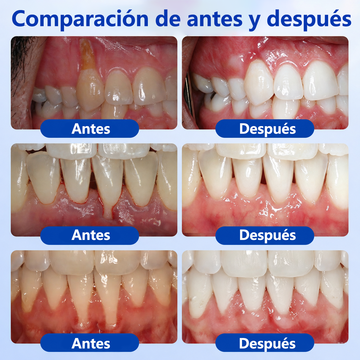 𝐂𝐞𝐫𝐭𝐢𝐟𝐢𝐜𝐚𝐝𝐨 𝐩𝐨𝐫 𝐎𝐝𝐨𝐧𝐭ó𝐥𝐨𝐠𝐨𝐬✨𝑽𝐢𝘁𝒂𝒍𝒊𝒔𝒚𝒔®🦷 𝑮𝒖𝒎𝑹𝒆𝒗𝒊𝒗𝒆 𝑮𝒆𝒍 𝑹𝒆𝒑𝒂𝒓𝒂𝒅𝒐𝒓 𝑷𝒆𝒓𝒊𝒐𝒅𝒐𝒏𝒕𝒂𝒍💕