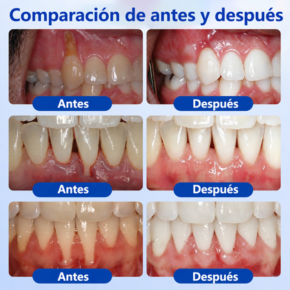 𝐂𝐞𝐫𝐭𝐢𝐟𝐢𝐜𝐚𝐝𝐨 𝐩𝐨𝐫 𝐎𝐝𝐨𝐧𝐭ó𝐥𝐨𝐠𝐨𝐬✨𝑽𝐢𝘁𝒂𝒍𝒊𝒔𝒚𝒔®🦷 𝑮𝒖𝒎𝑹𝒆𝒗𝒊𝒗𝒆 𝑮𝒆𝒍 𝑹𝒆𝒑𝒂𝒓𝒂𝒅𝒐𝒓 𝑷𝒆𝒓𝒊𝒐𝒅𝒐𝒏𝒕𝒂𝒍💕